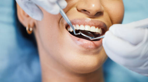 Best Emergency Tooth Extraction in Salina, UT